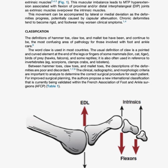 article-technique-percutanee-deformations-des-orteils-lateraux2